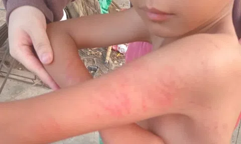 Xử lý vụ học sinh lớp một bị đánh, phụ huynh đến trường tát cô giáo