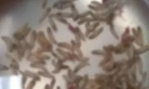 Đau mũi đi khám, bác sĩ sốc nặng khi lấy ra thứ trong mũi người phụ nữ