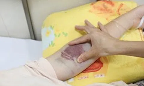 Thái Bình: Giám sát chặt chẽ, không để lan rộng dịch sốt xuất huyết