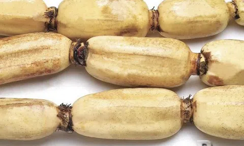 2 loại củ dễ là “ổ ký sinh trùng" mắt thường không thấy được, loại đầu bảng nhiều người mê