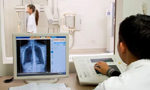 Bộ Y tế: Không lấy thời gian chụp X-quang 6 phút làm căn cứ từ chối thanh toán BHYT