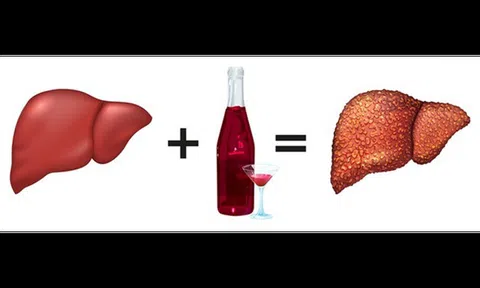 Bệnh gan tăng vọt sau Tết: Chuyên gia chỉ rõ thói quen "gánh nặng" nội tạng