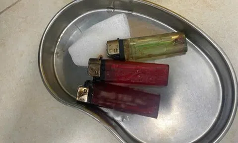 Bác sĩ sốc khi phát hiện 3 chiếc bật lửa trong bụng nam thanh niên