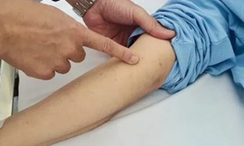 Phú Quốc ghi nhận ca nghi viêm màng não mô cầu, ngành y tế tăng cường giám sát và phòng ngừa