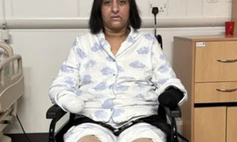 Bị chó cưng liếm, người phụ nữ "sốc" khi phải cắt cụt tay chân