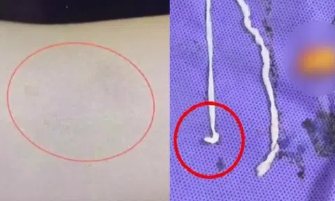 Người phụ nữ đau tay đi khám, bác sĩ kinh ngạc khi thấy thứ bên trong